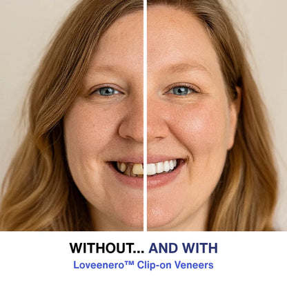 Loveenero clip-on veneers for a natural-looking smile, perfect dental solution and cosmetic teeth enhancement.